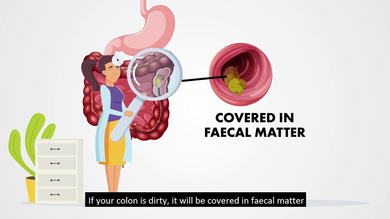 Colonoscopy Preparation | By NUH Colorectal Centre